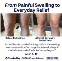 StrideKnee™ Performance Recovery Device
